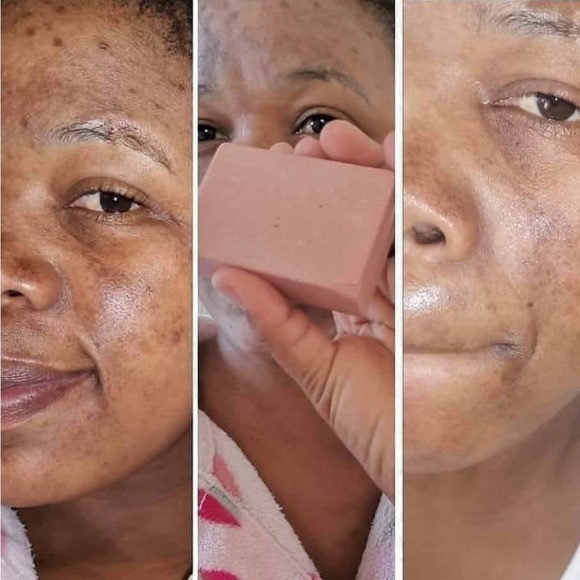 Exfoliating bar - Picture 3 of 5